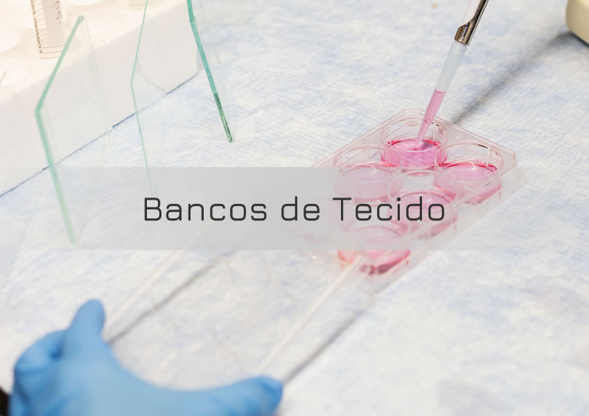 bancos-de-tecidos.jpg